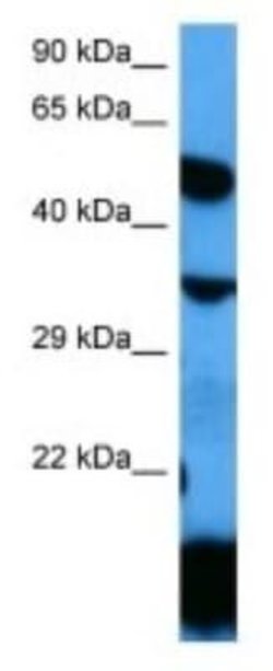 LMBR1L Rabbit anti-Human, Polyclonal, Novus Biologicals:Antibodies:Primary